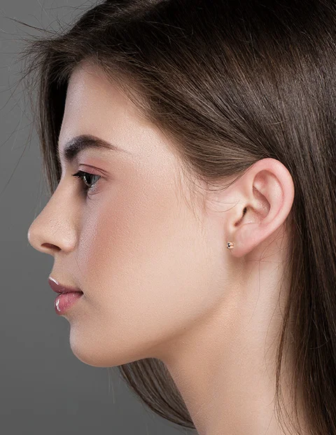 corrección de orejas despegadas